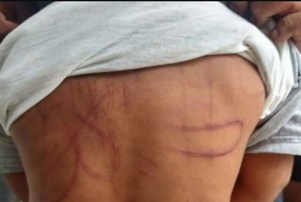Rescatan a niño de tres años victima de violencia en Valle de Chalco