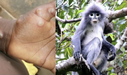 Por exposición a viruela del mono monitorean en EU a 200 personas