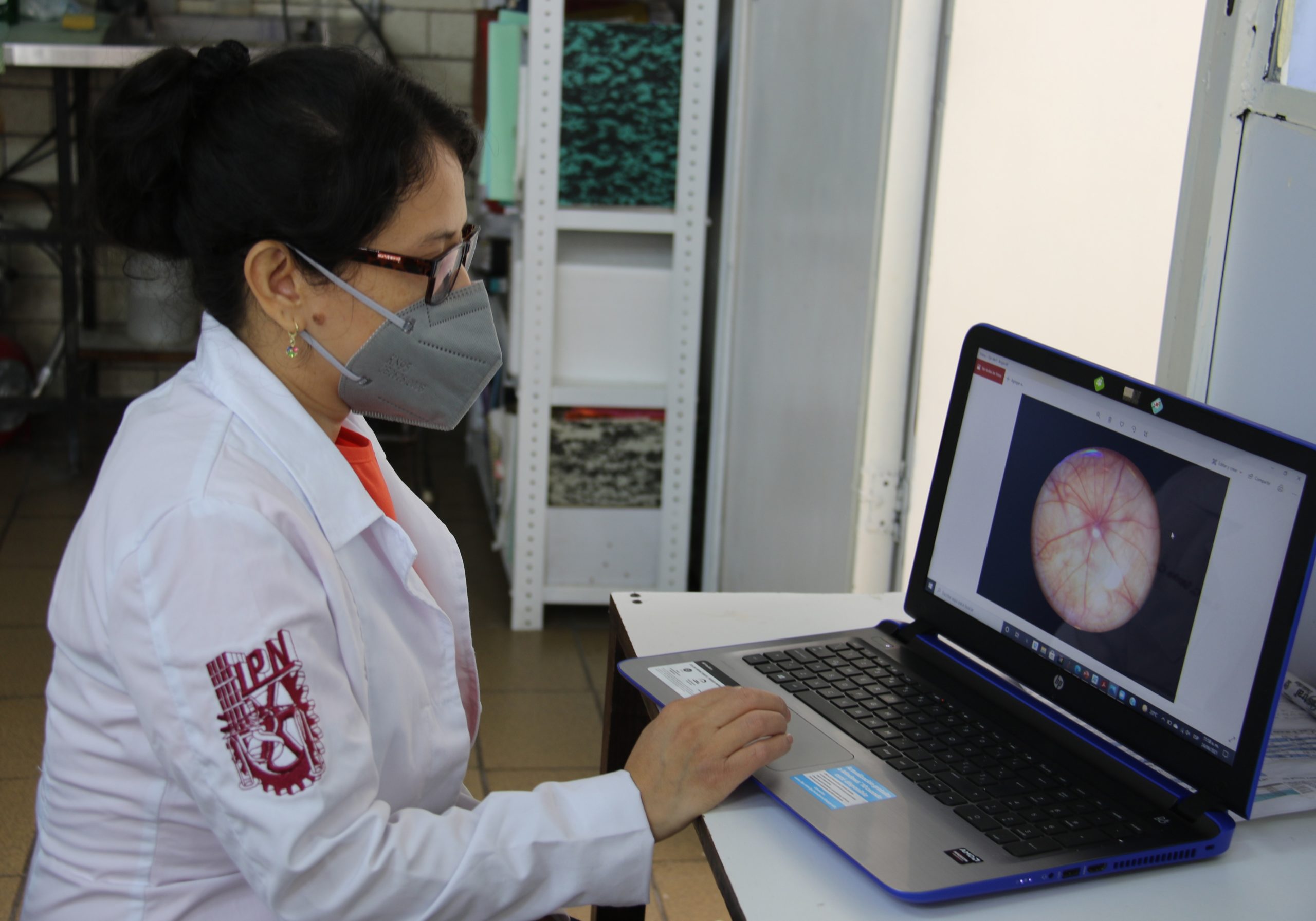 Reduce IPN retinopatía diabética con silenciamiento génico