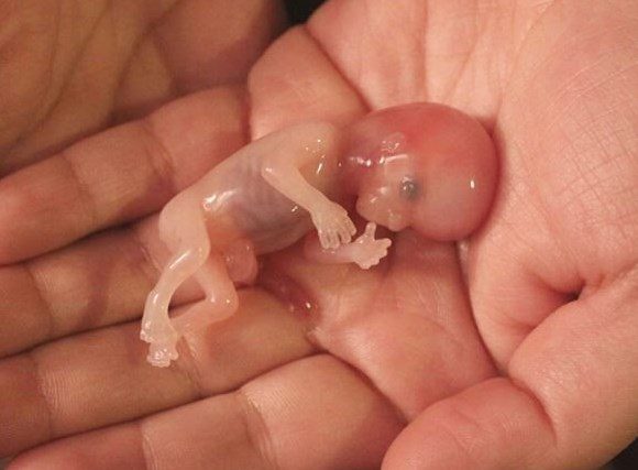 Muertes fetales descienden en México, ocurrían principalmente en Edomex