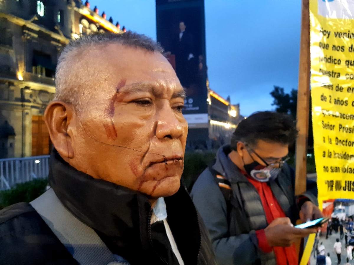 Se cose los labios en protesta afuera de Palacio Nacional