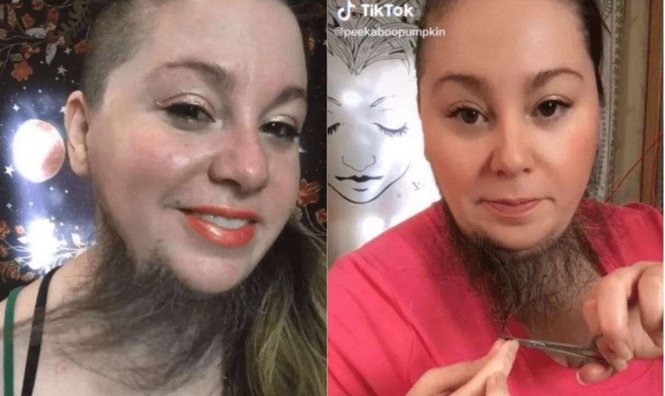 Mujer con barba se vuelve sensación en OnlyFans por lucir diferente