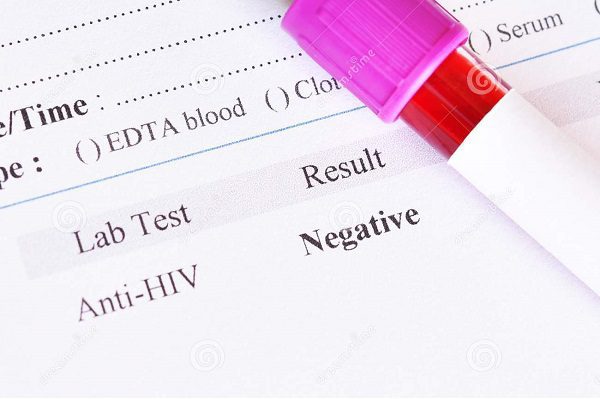 Identifican el segundo caso de una persona que se cura del VIH sin medicamentos