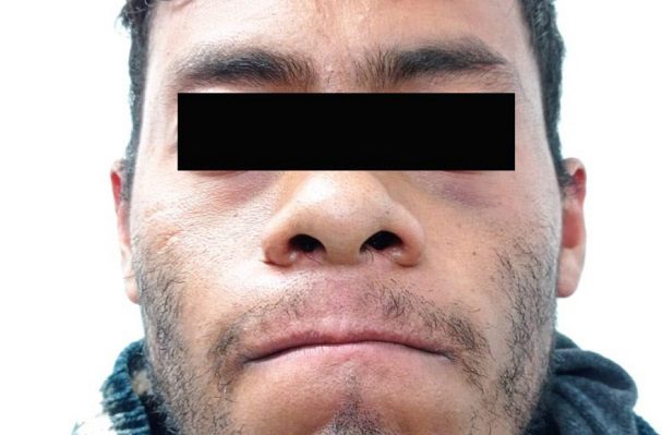 Sujeto decapita a sus suegros y es detenido con sus cabezas, en Puebla