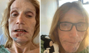 Mujer trans es encerrada en cárcel de hombres y uno le rompe la mandíbula