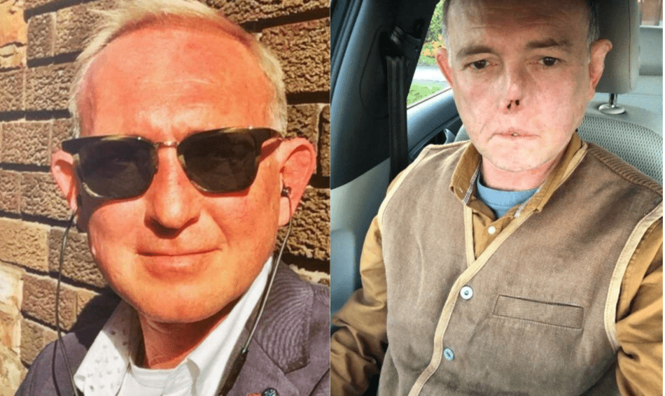 Doctor pierde nariz y piernas por lamida de perro