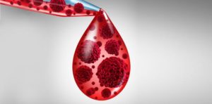 Científicos descubren subtipo de cáncer en la sangre