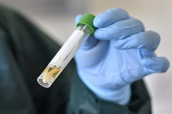 Secretaría de Salud de Sinaloa estudia posible caso de variante Ómicron