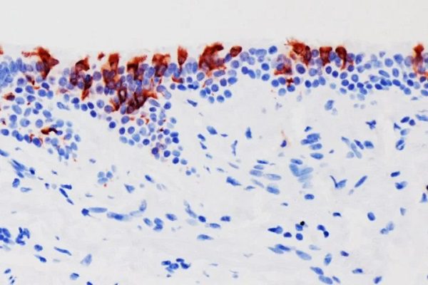 Científicos toman la primera fotografía de la variante Ómicron