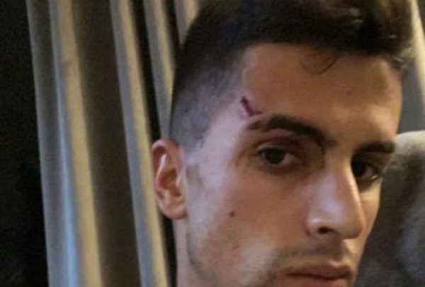 Hieren a Joao Cancelo, jugador del Manchester City, en violento robo