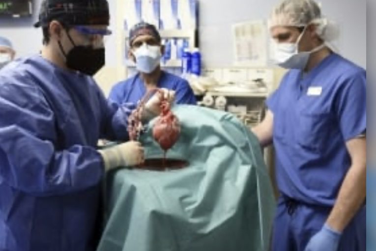 Trasplantan exitosamente corazón de cerdo a persona