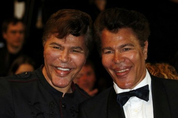 Gemelos estrellas de la televisión francesa, mueren por Covid con días de diferencia