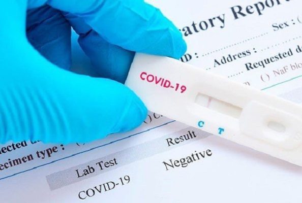 Documentan caso de hombre que dio positivo a Covid-19 durante 232 días