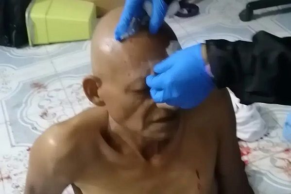 Atacan y lesionan al periodista Jaime Vargas Chablé, en Yucatán