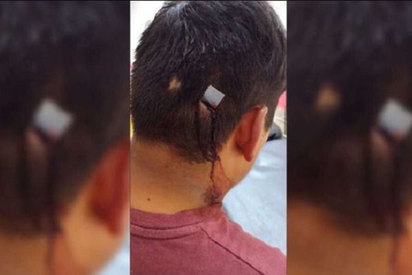 Entierran cuchillo en la cabeza a hombre por embarazar a familiar menor de edad