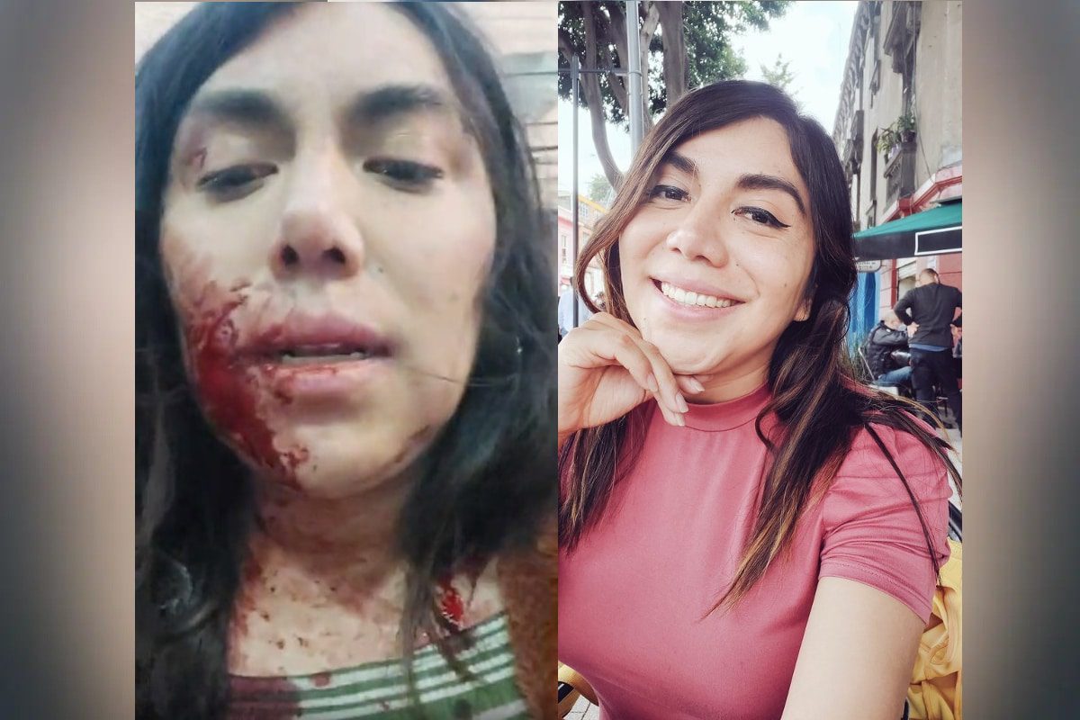 Cae presunto agresor de Natalia Lane, activista trans agredida en Tlalpan