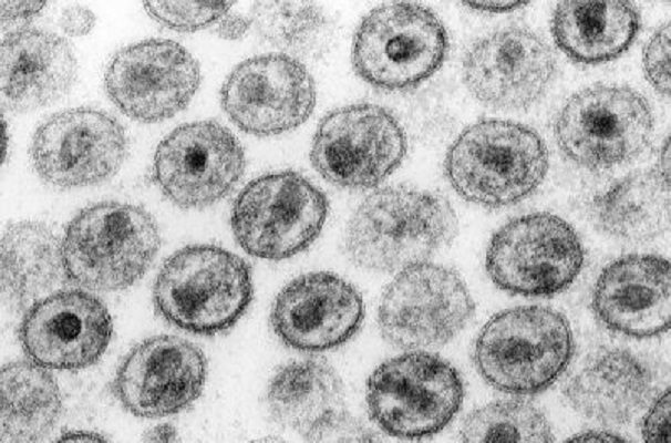 Descubren una nueva variante de VIH más virulenta y contagiosa