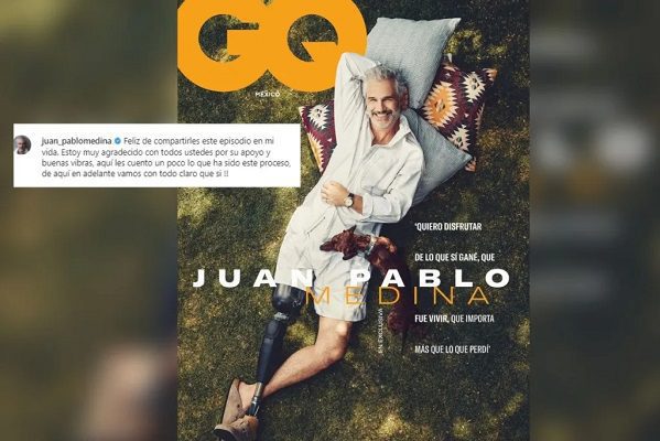 El actor Juan Pablo Medina reaparece en portada de revista con su nueva prótesis
