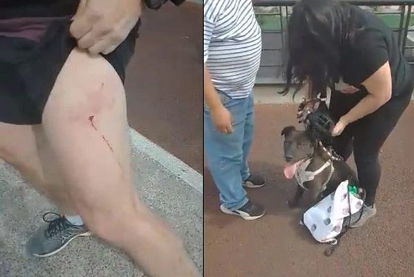 Perro pitbull ataca y muerde a un joven en Parque La Mexicana #VIDEO
