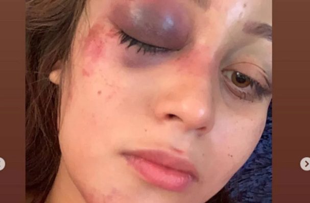Influencer de Guanajuato denuncia violencia de su expareja