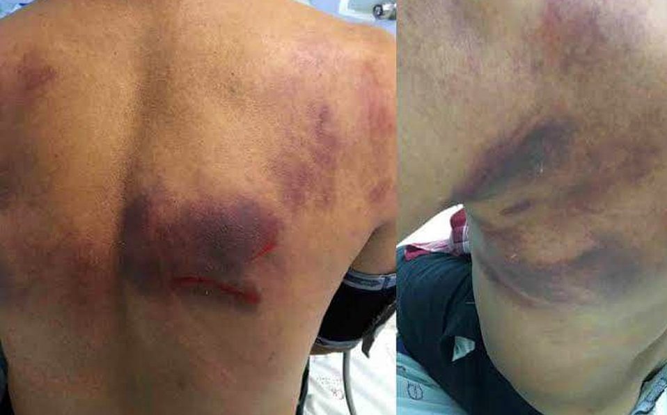 Denuncian exagerada golpiza en representaciones del Viacrucis en Toluca