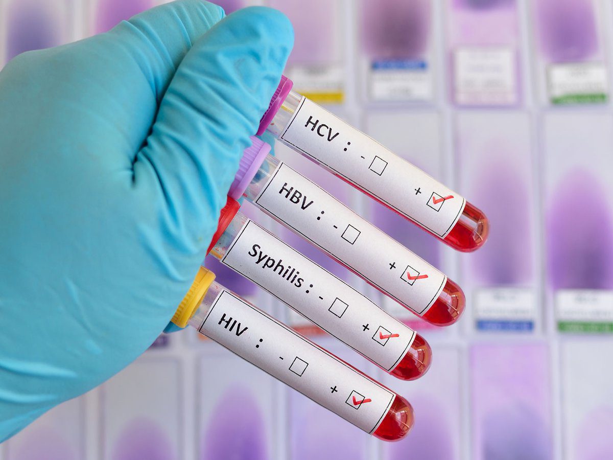 ETS en Estados Unidos