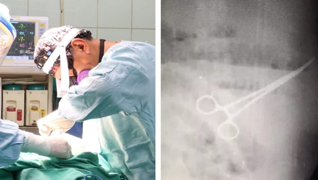 Médicos venezolanos olvidan tijeras en estómago de paciente
