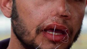 Migrantes se suturan los labios para exigir al INM su visa humanitaria