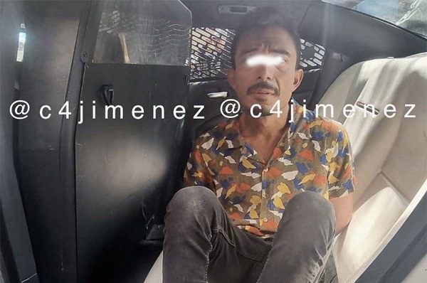 Estudiante del IPN atacado con tabique podría perder el olfato y el gusto