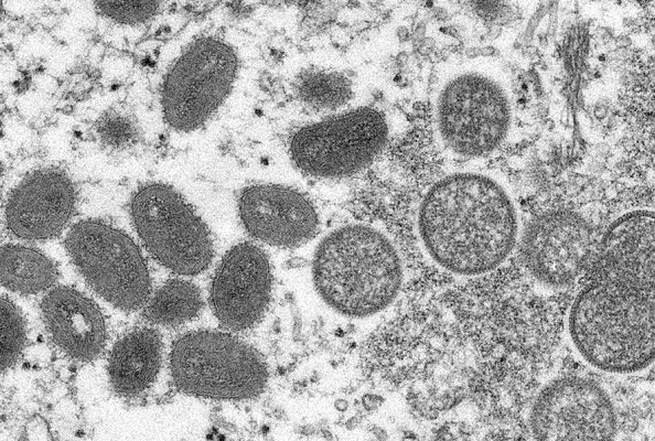 OMS convoca a expertos tras reporte de casos de viruela del mono en Francia y Alemania