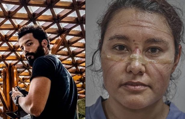Roban equipo a fotógrafo mexicano que retrató a doctores al inicio de la pandemia