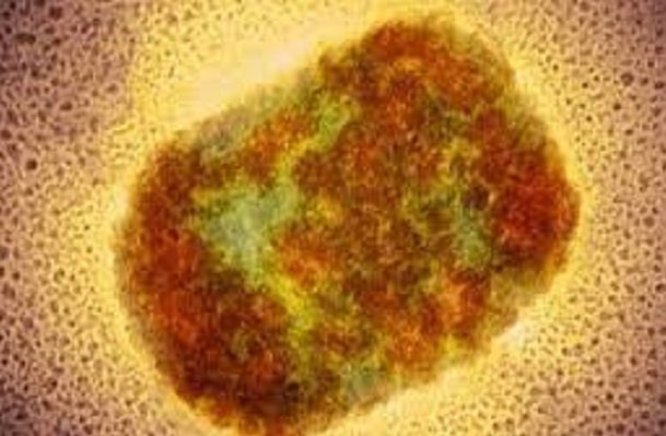 Suman cinco casos de la viruela del mono en México, reporta López-Gatell