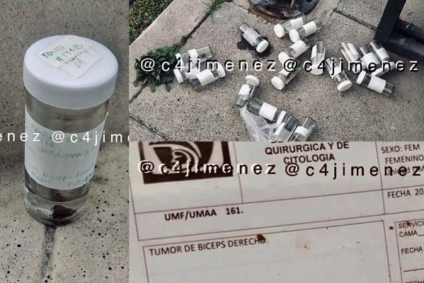 Abandonan frascos con tejidos humanos del IMSS en la Cuauhtémoc