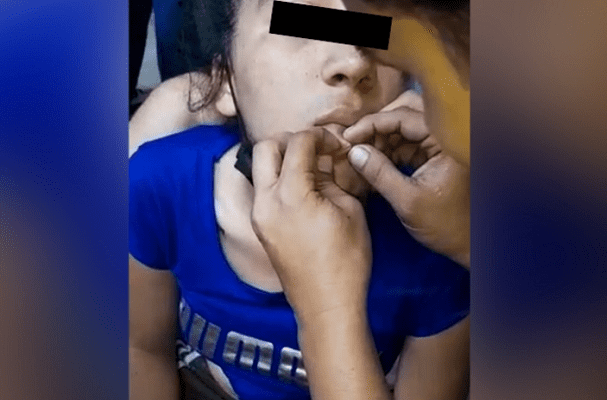 Migrantes varados en Monterrey se cosen los labios como protesta #VIDEO