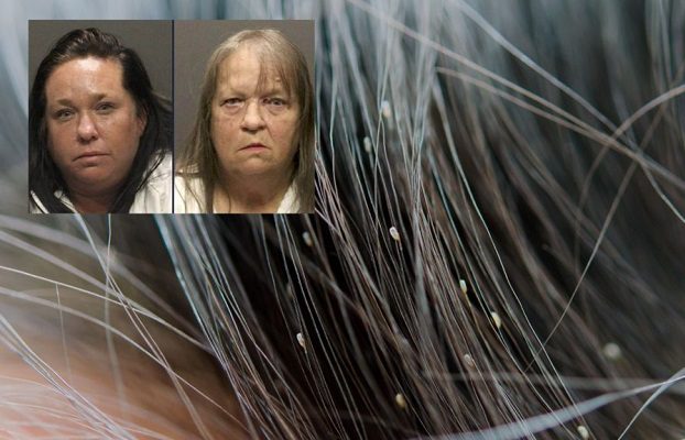 Niña muere de desnutrición y anemia tras ser infestada por piojos