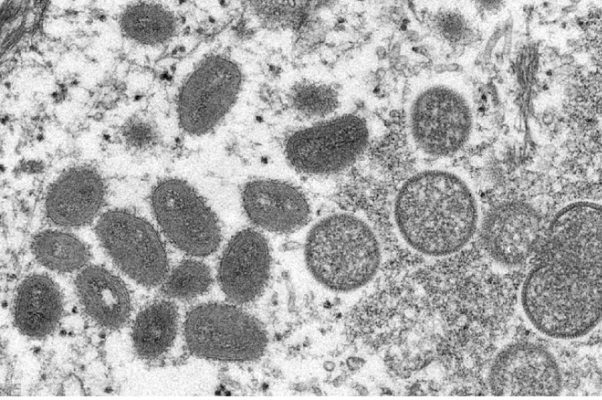 Viruela del mono suma 2,103 casos confirmados en 42 países y una muerte: OMS