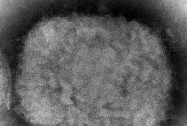 Patógeno de la viruela del mono ha mutado ferozmente, advierte estudio