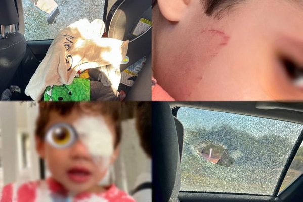 Periodista en Sonora denuncia que su hijo fue herido en el ojo tras ataque a pedradas