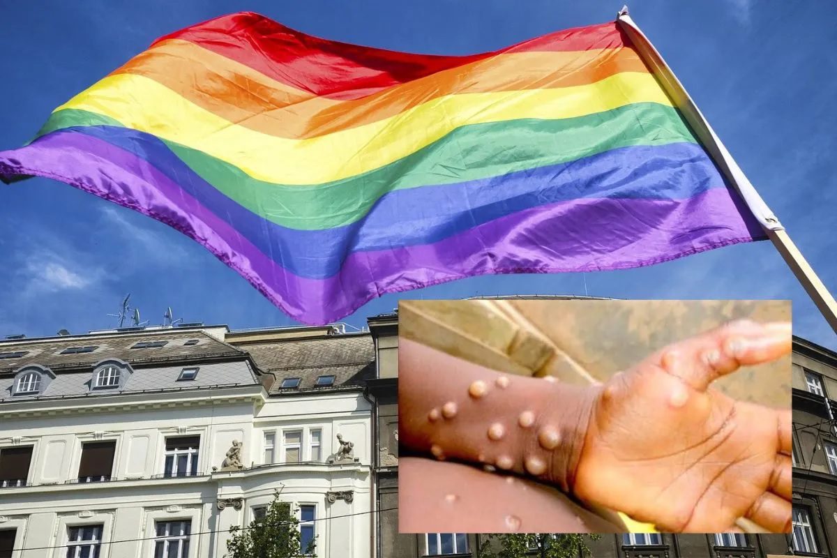 Población LGBT y la viruela símica