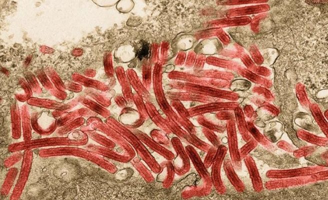 Dos personas que murieron en Ghana dieron positivo al virus de Marburgo: OMS