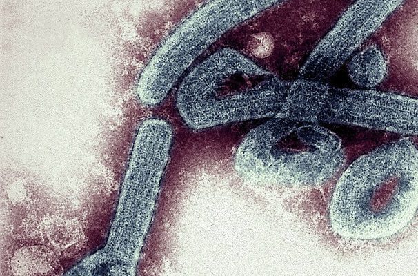 Ghana confirma primer brote de virus de Marburgo, de la misma familia que el ébola