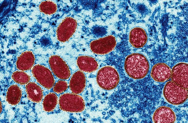 Experto de la OMS prevé que viruela del mono no tarde en declararse pandemia