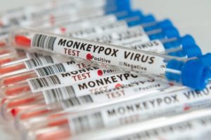 López-Gatell confirma 60 casos de viruela del mono en 11 estados del país
