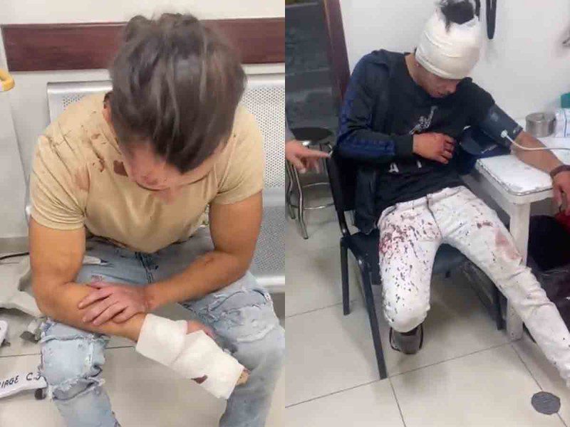 Jóvenes golpeados y asaltados afuera de un bar en la Zona Rosa