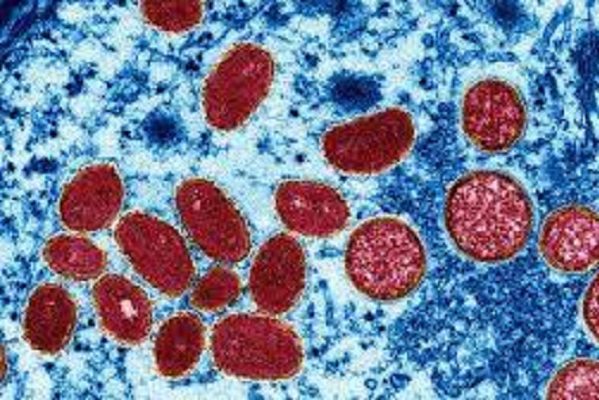 Los casos globales de viruela del mono superan los 26 mil, reporta la OMS