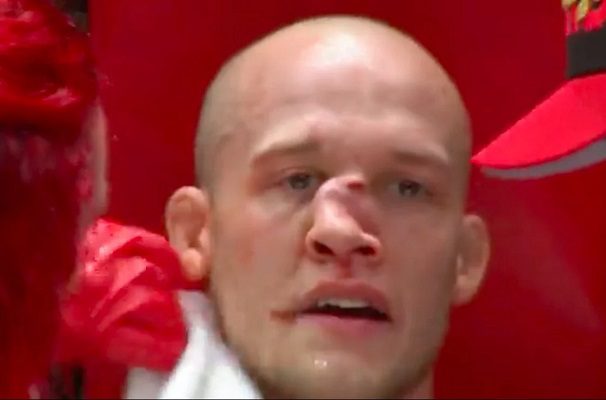 Pelador de MMA termina con la nariz desfigurada tras brutal golpe #VIDEOS