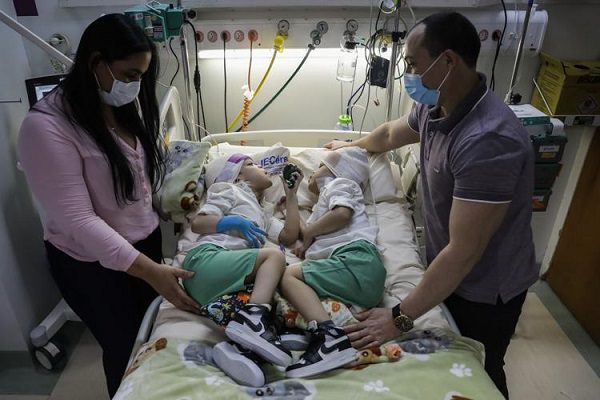 Cirugía que separó a siameses en Brasil es ofrecida a otros niños de Latinoamérica