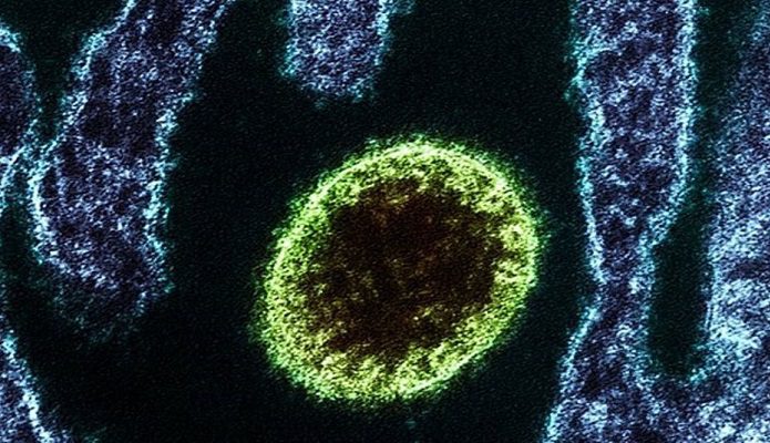 Identifican en China nuevo virus de origen animal con 35 infectados confirmados