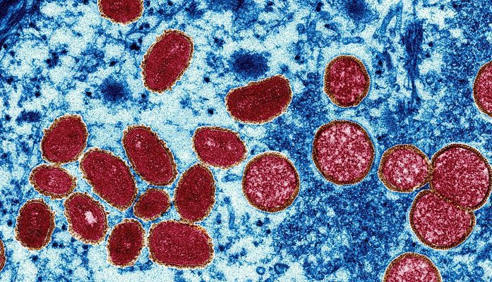 Contagios de viruela del mono aumentaron un 20% en una semana, alerta OMS