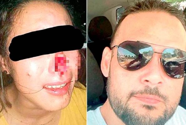 Acusan a excandidato en Veracruz de arrancar pedazo de nariz a mujer por rechazarlo